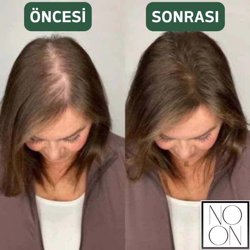 NOON®  – Rosemary Organik Biberiye & Saç Güçlendirici Şampuan