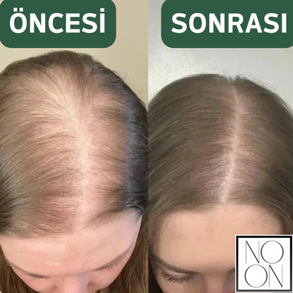NOON®  – Rosemary Organik Biberiye & Saç Güçlendirici Şampuan